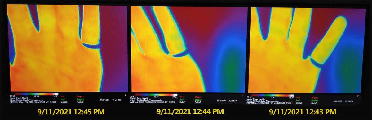far-infrared-ring-radiant-body-thermograph